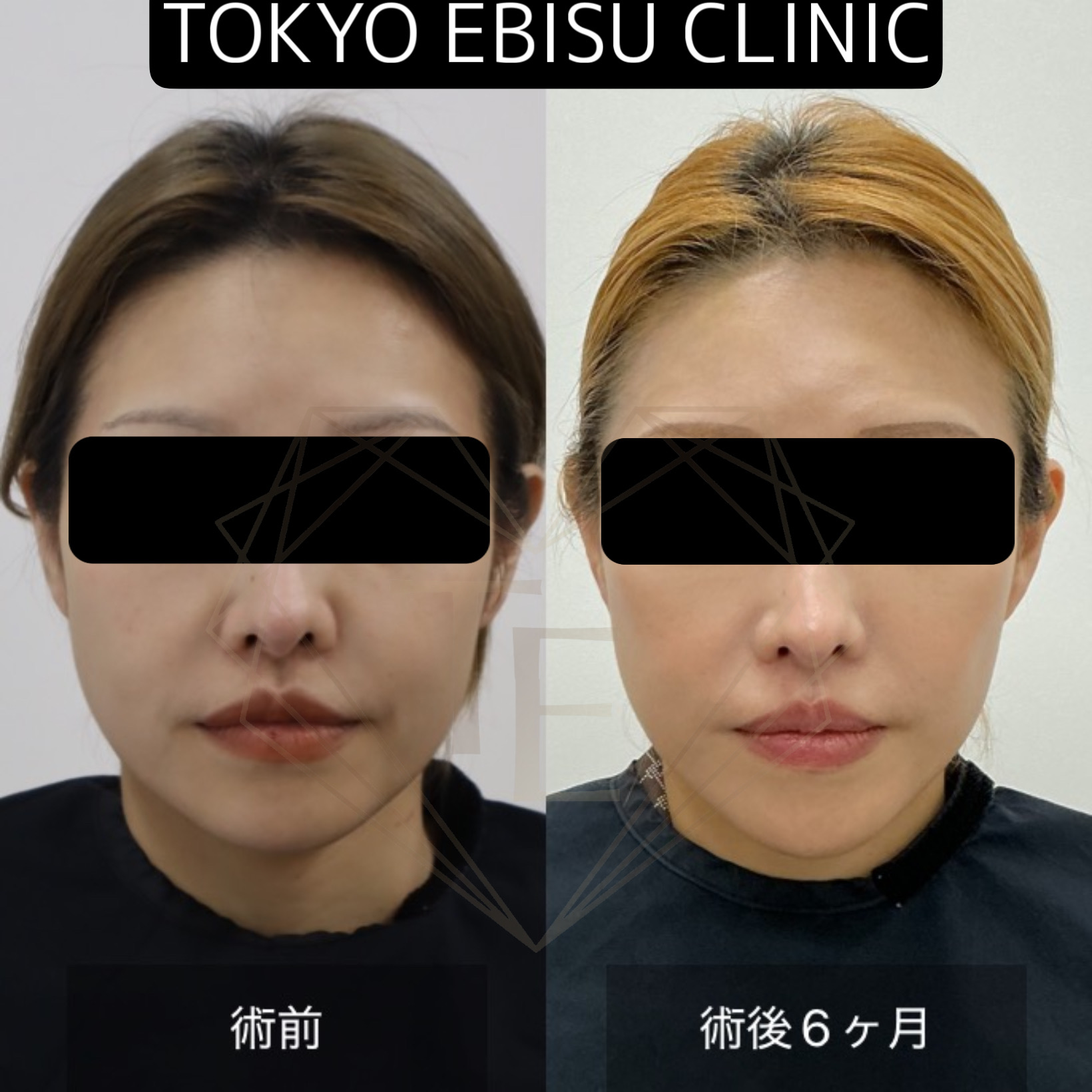 5b57eb2ea24316428b51d3436fed2bdc