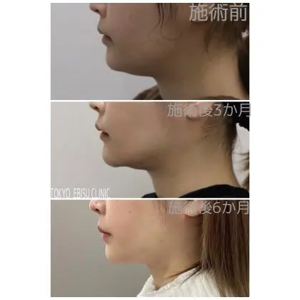 75c221d73aaefde1e0734732b5847b9d-420x420-1