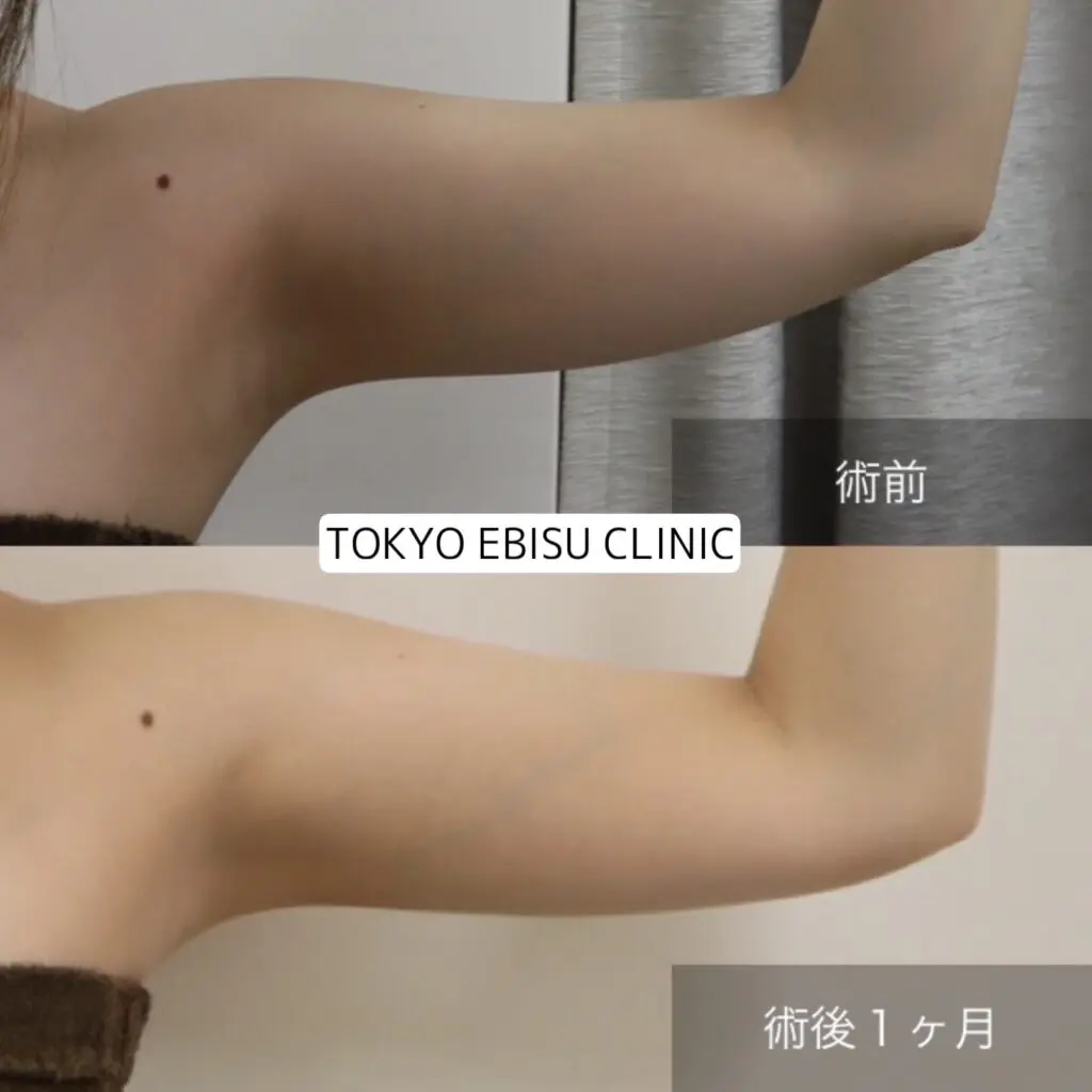 7d8ab906-13cc-4c1b-8366-39f779052787-1-1024x1024-1