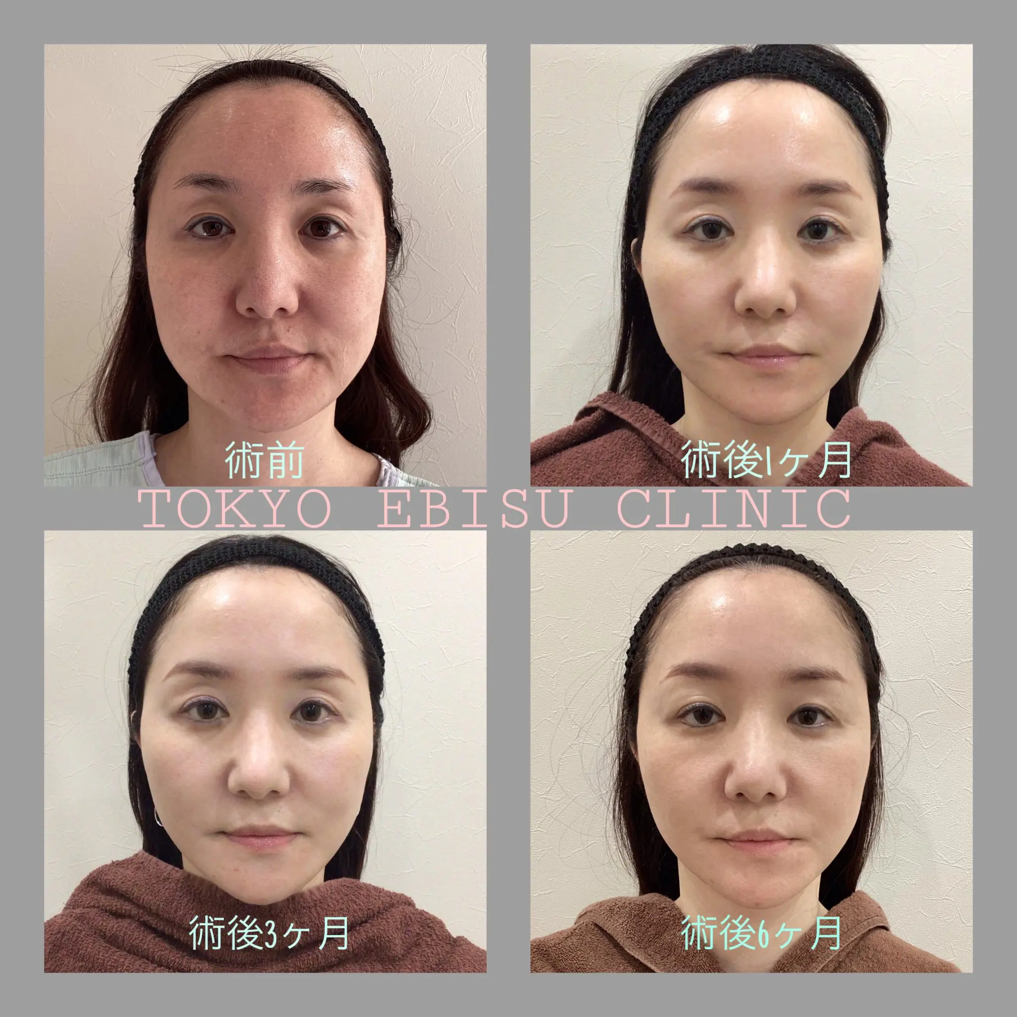 8e89dde7-488b-4df7-b401-6a1b01151d69-2048x2048-1