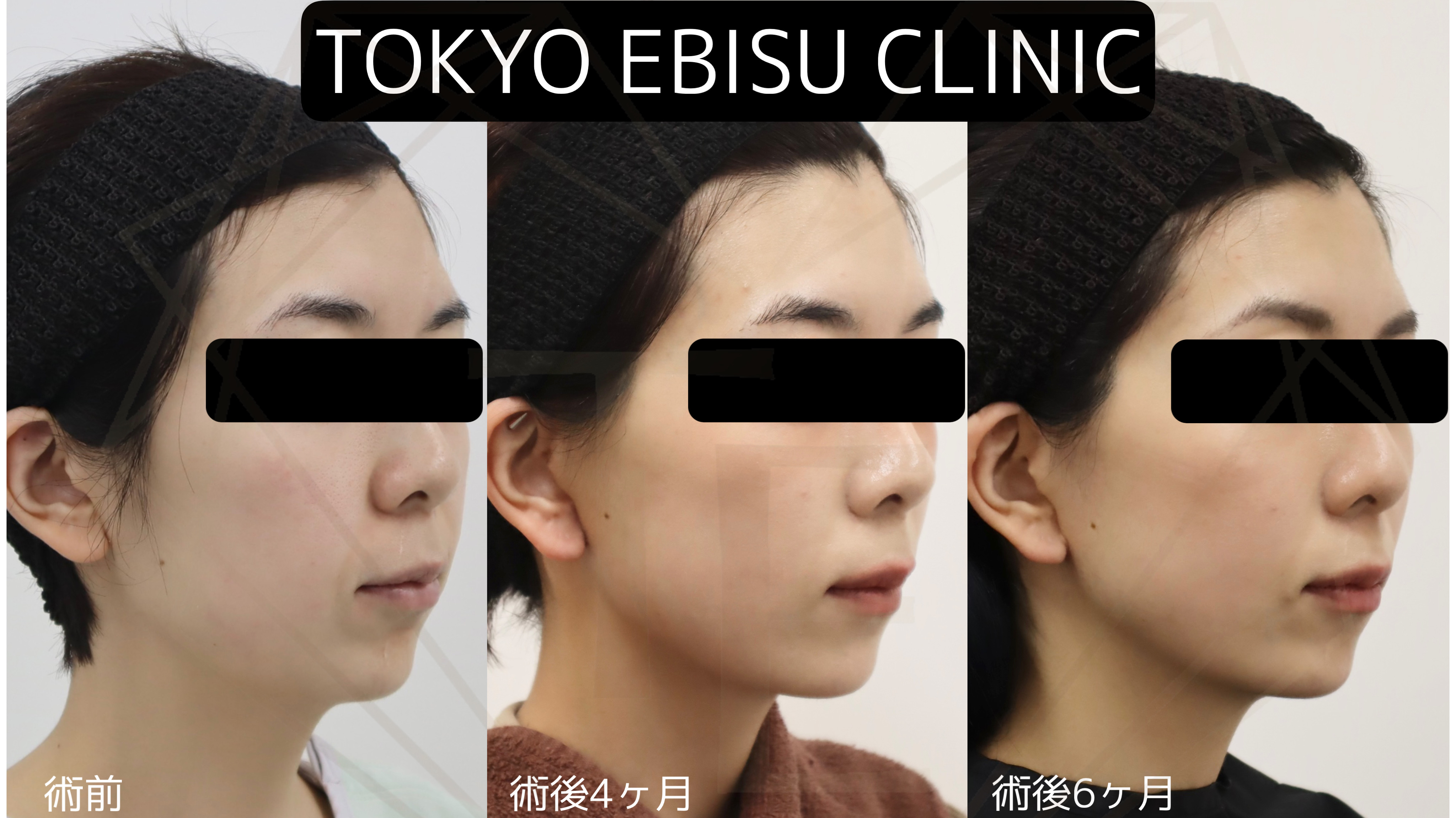 ade8262b50c3621d25446c1745b9de69