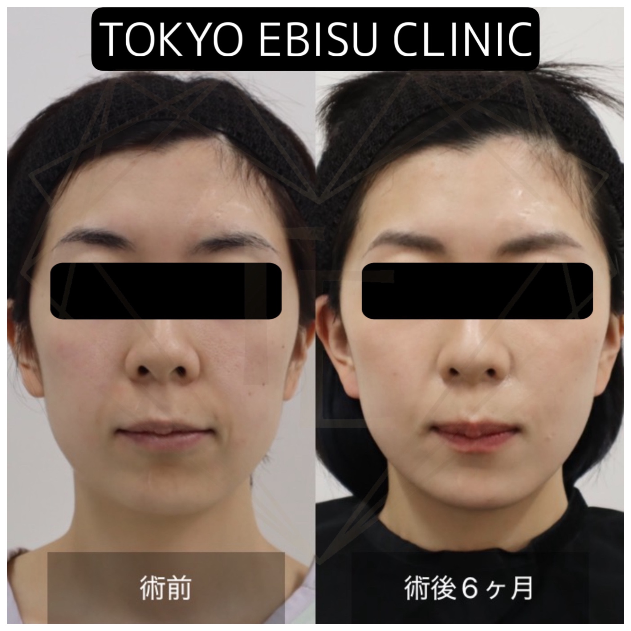 bf30907454bfe31e1dcf0a64eacf9525