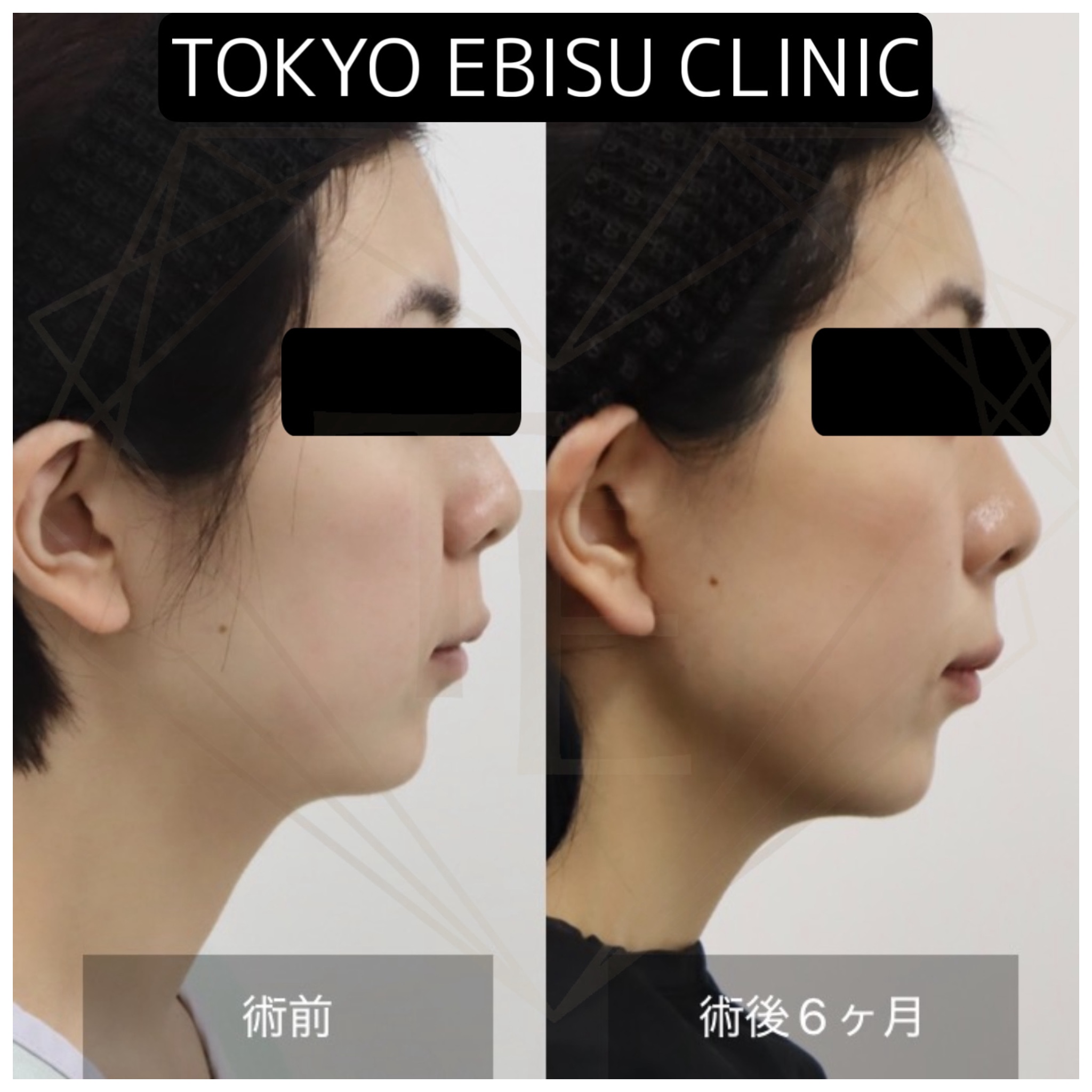 d93e7991ad6c9696d15a8158e7100d1d