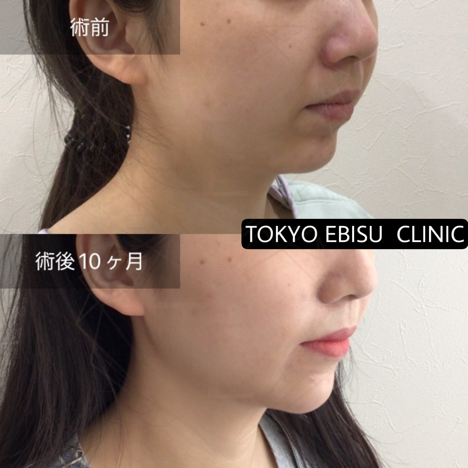 f5d751bb7d2d236cdabfe671f9318d87