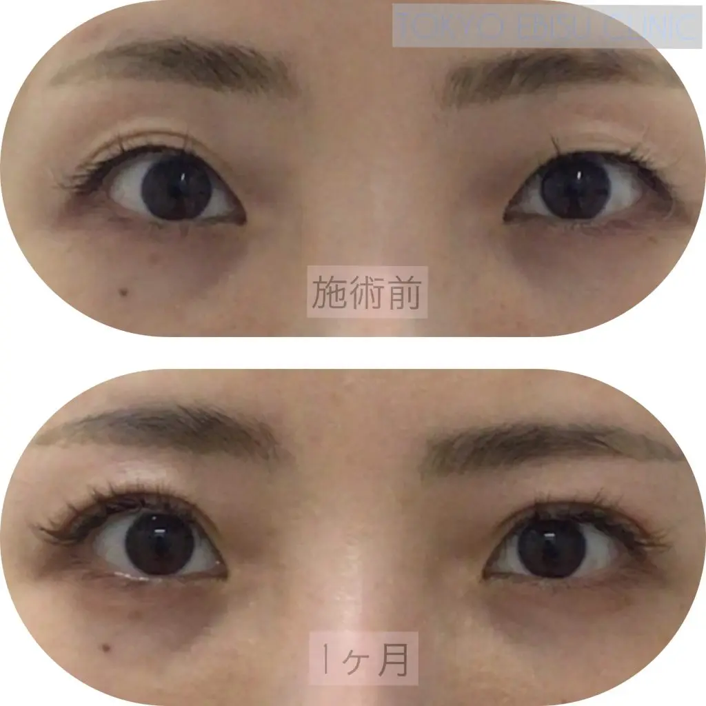 photo-output-1024x1024-1