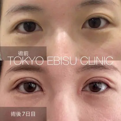 photo-output-14-420x420-1