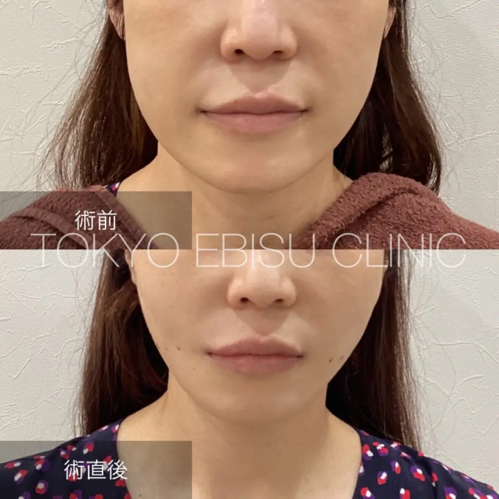 photo-output-17-1024x1024-1