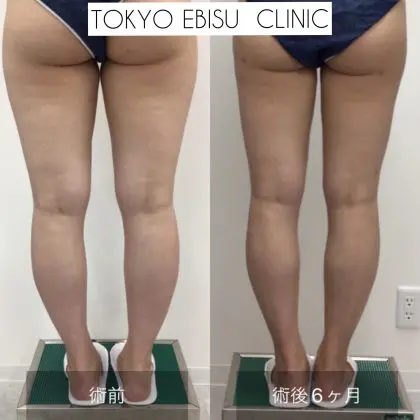 photo-output-29-420x420-1