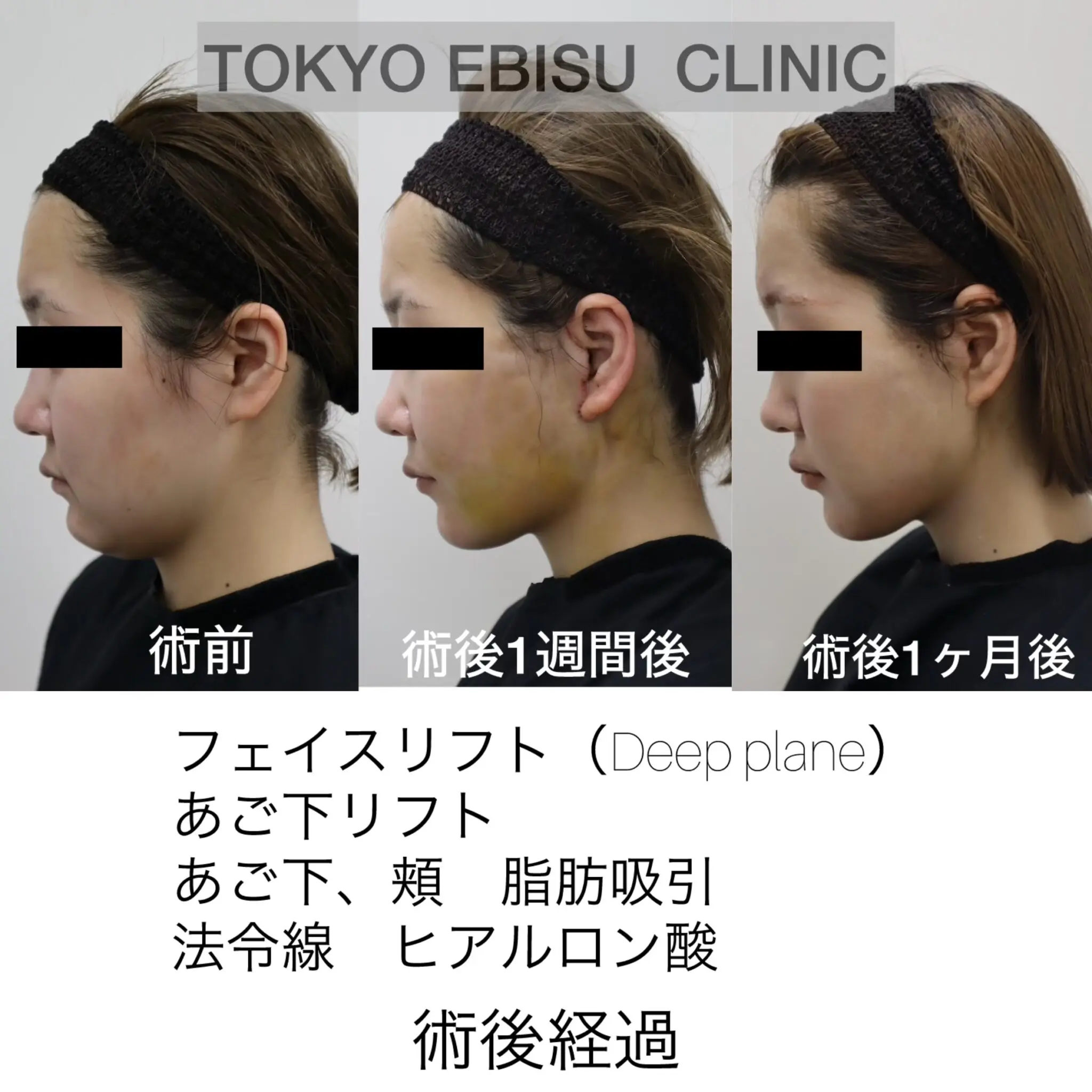 photo-output_original-1-1-2048x2048-1