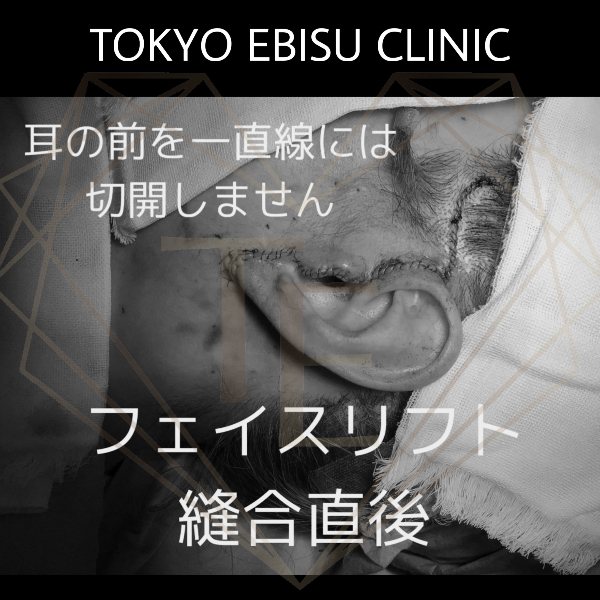 e21f13c3d0fb9723d86f4a56b093f6dc