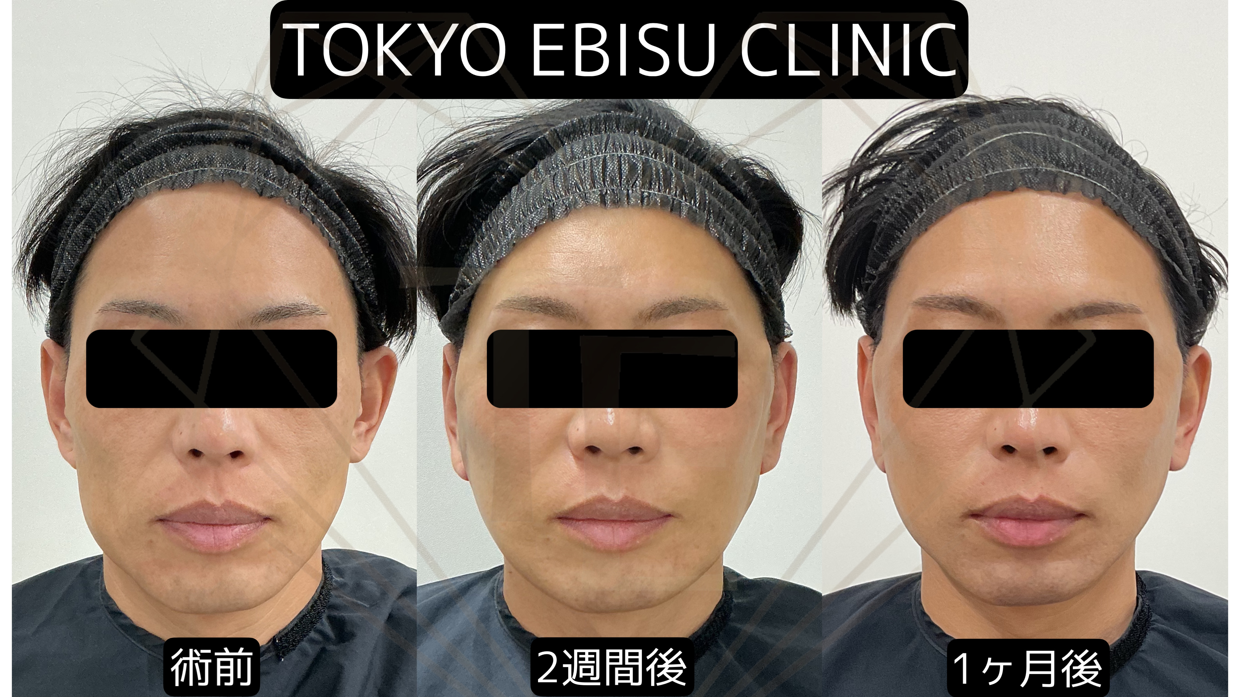 8da071d851ce5a21f15a0194166203f6