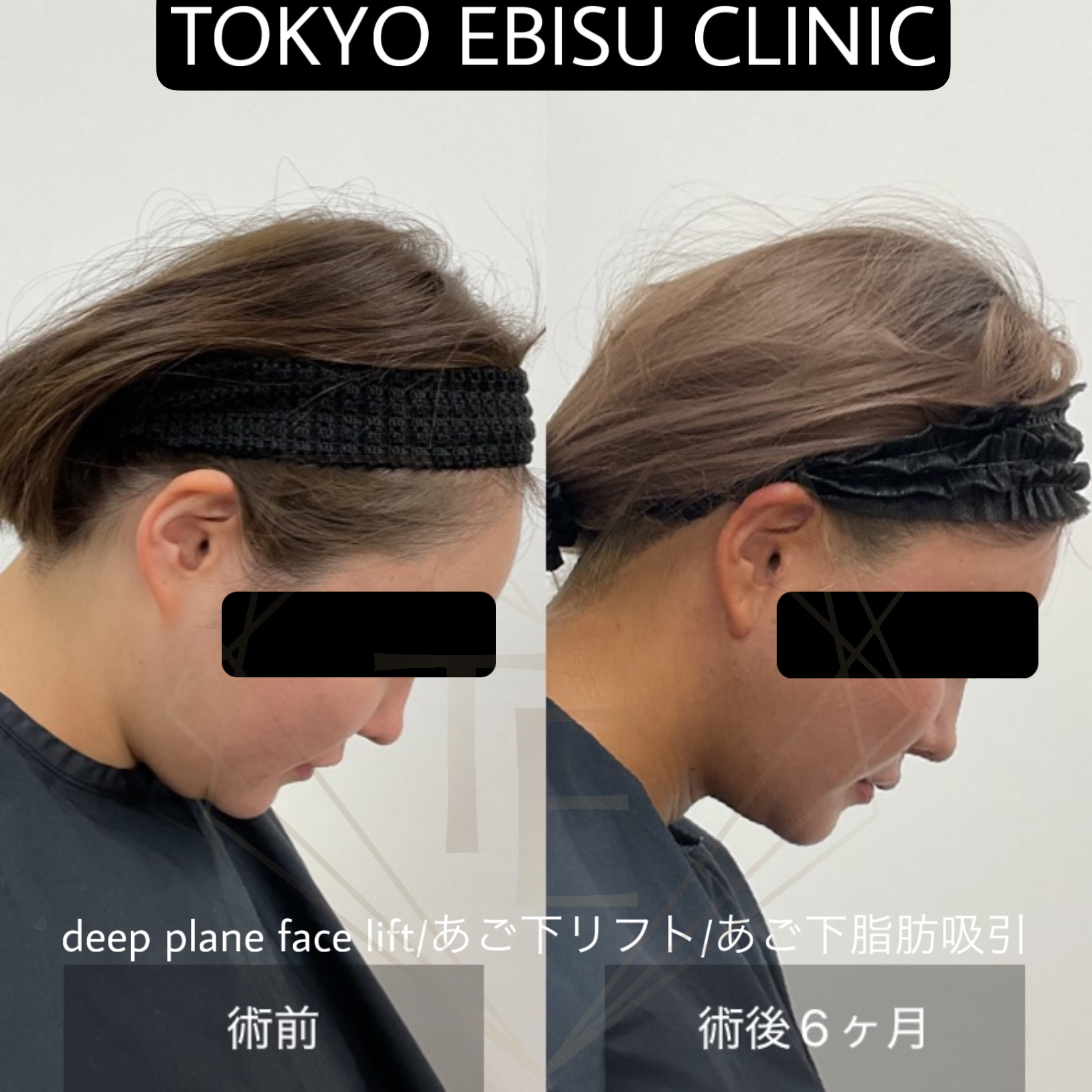 da4559b38ea8d520b343f76ce8408124