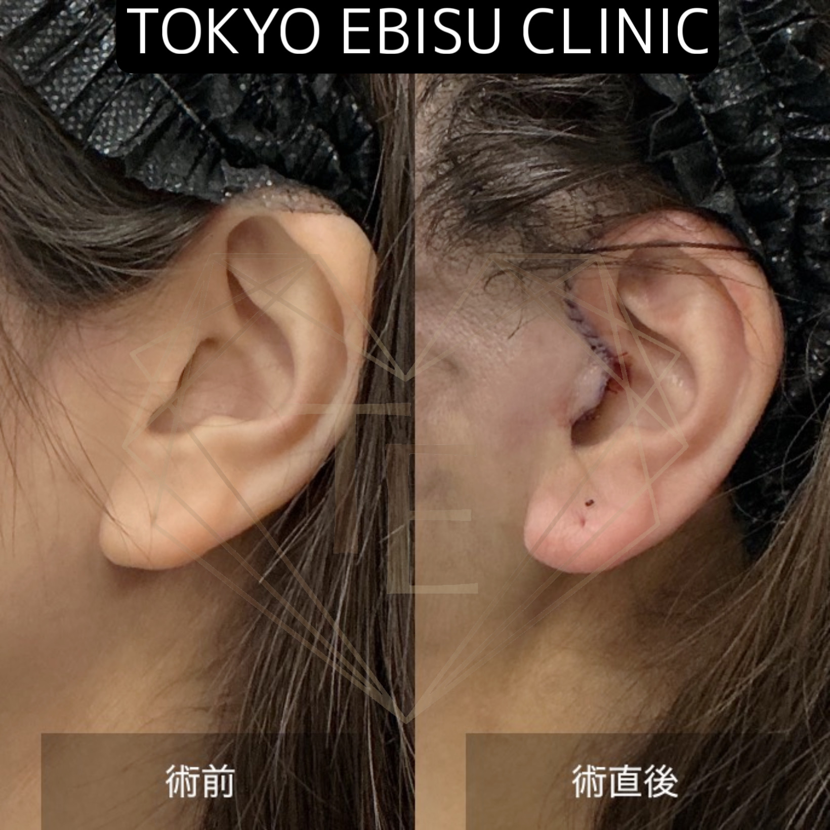 9755a47fb795d6eae4879b00b389a61f